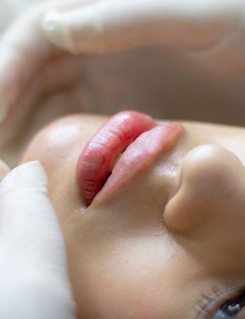 harmonisation_levres